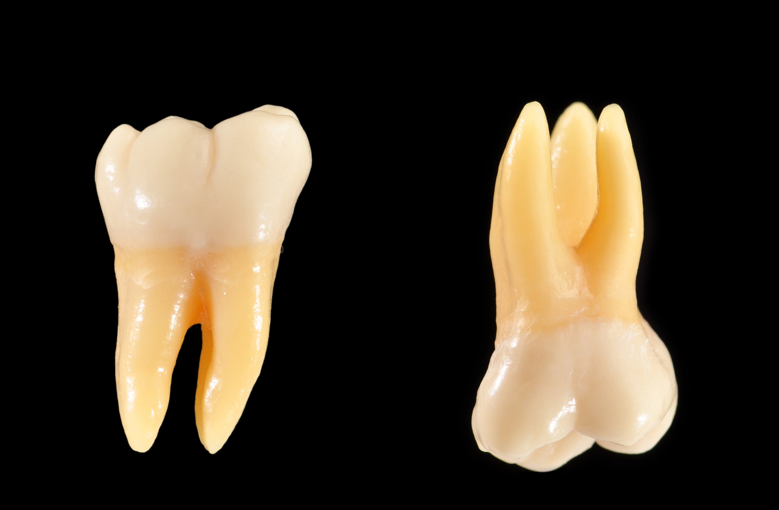 Molar extraction